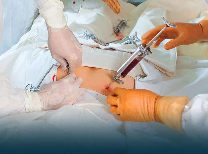 How to Manage Bone Marrow Transplant Cost When Traveling from Kenya